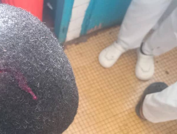 Côte d’Ivoire : au moins18 blessés dans un conflit foncier entre Samogossoba et Kouto